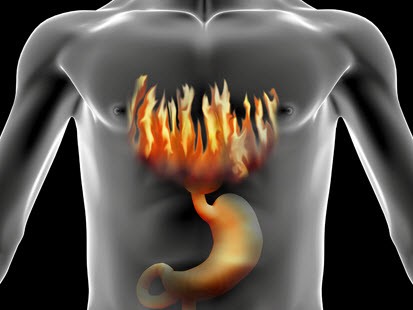 How to stop heartburn with folk remedies