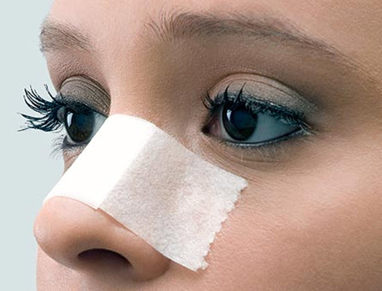 Simple Tips for Getting Rid of Blackheads
